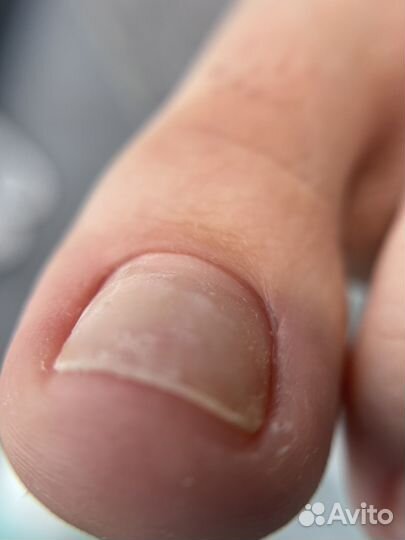 Требуются модели на педикюр