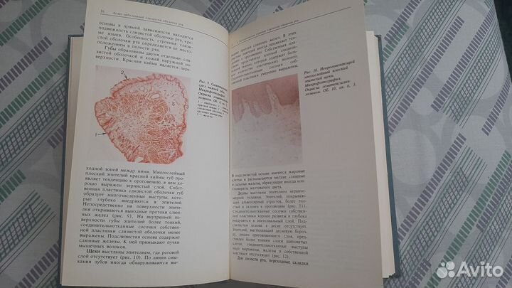 Атлас заболеваний слизистой оболочки рта