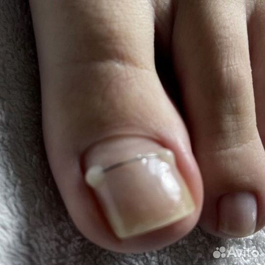 Медецинский педикюр.подолог.для мужчин И женщин