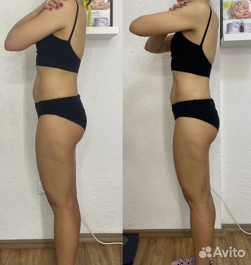 Горящая жопа аппаратный массаж