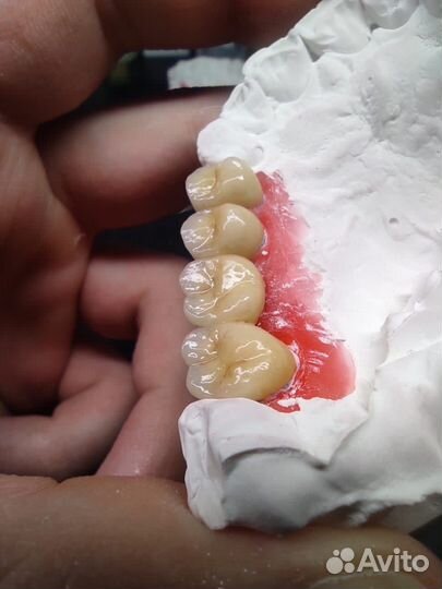 Зуботехнические услуги