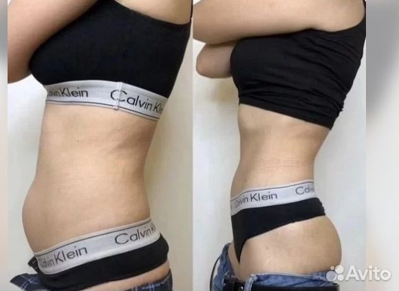 Плоский живот - размер за 1 процедуру