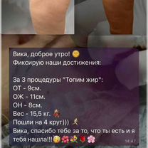 Косметолог/топим жир/худое лицо/лифтинг/губы, Химки