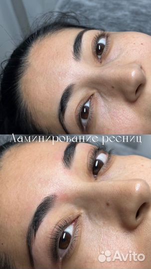 Брови Ресницы