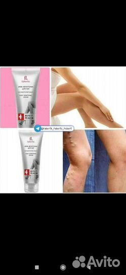 Для варикозе