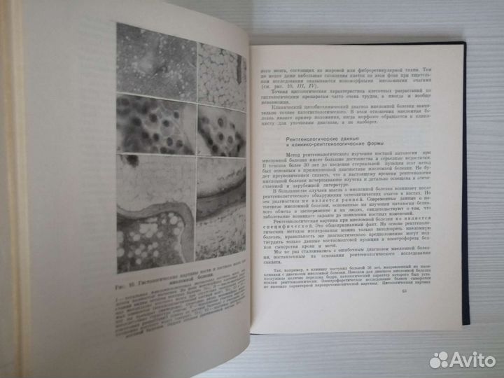 Миеломная болезнь (1966г.) / Г. Алексеев