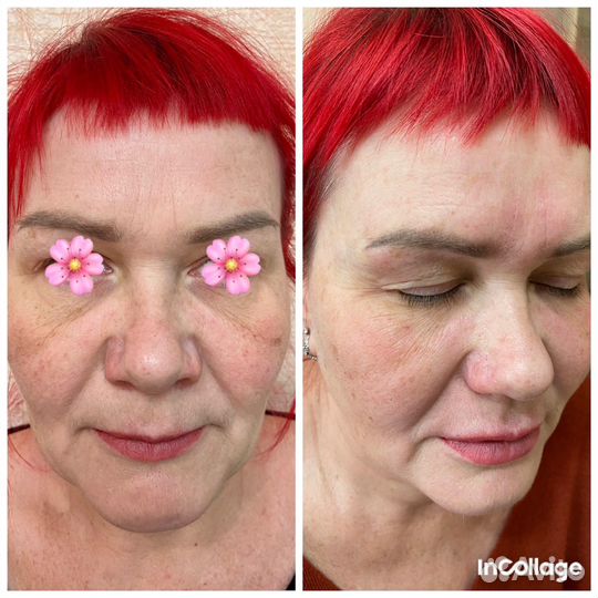 Услуги косметолога массажи инъекции чистка лица