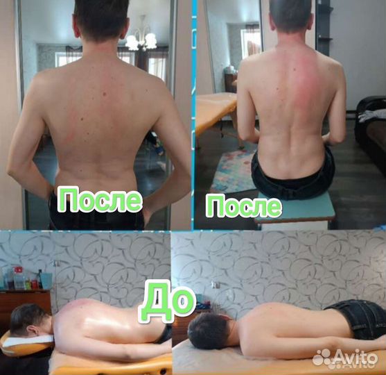 Мануальная процедура Высшей категории, массаж