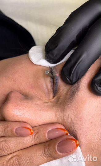 Удаление тату и перманентного макияжа