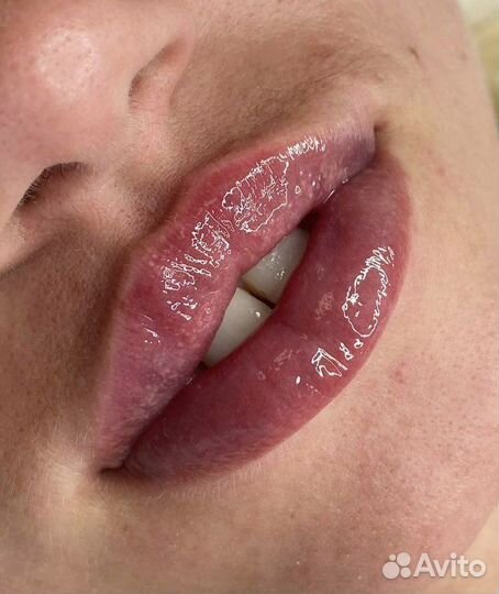 Услуги косметолога