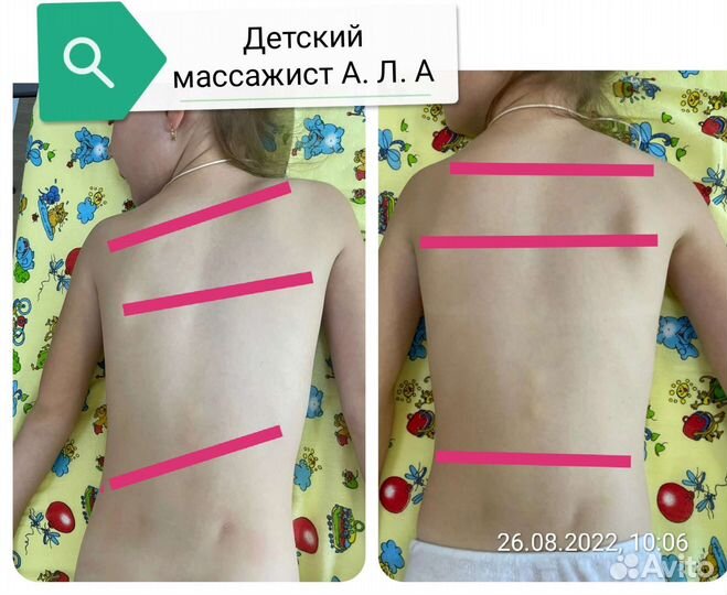 Детский массаж на дому