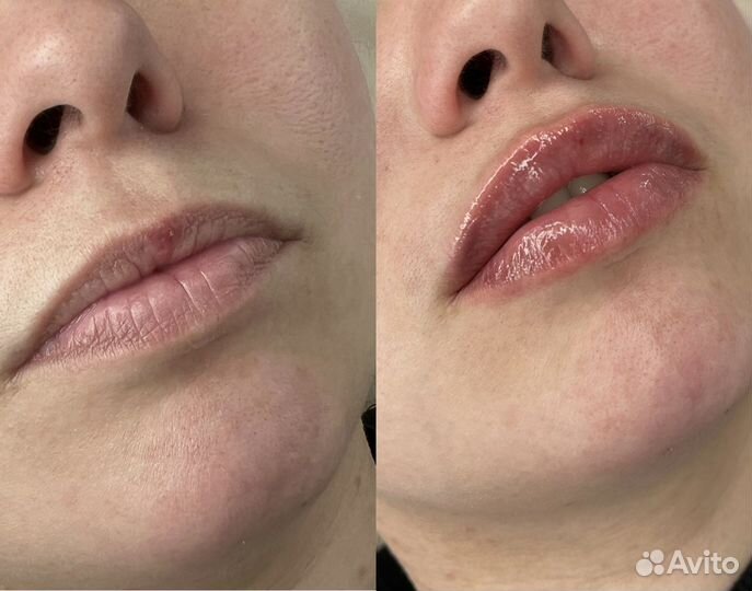 Услуги косметолога