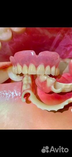 Зубные протезы