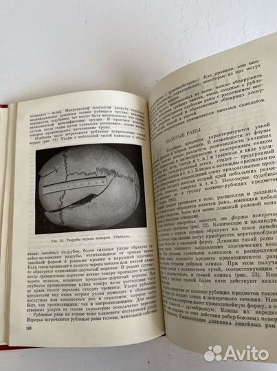 Книга. Судебная медицина. Ленинград Медицина Ленин