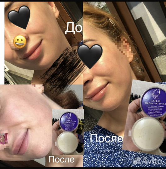 Маска-жгучка Лечебный крем Оригинал