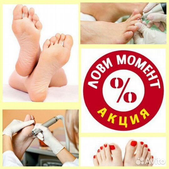 Педюкюр на дому(smart-педикюр)