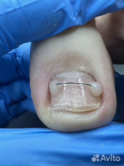 Подолог Бор