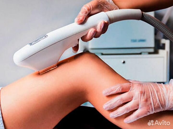 Готовый бизнес в сфере красоты — лазерная эпиляция