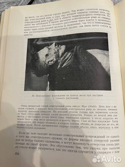 Медицинская криминалистика 1959 г. Э. Кноблох