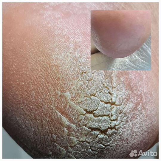 Маникюр и педикюр на дому