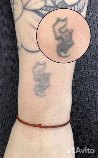 Удаление тату и татуажа