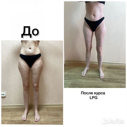 Массаж LPG оригинальный Французский