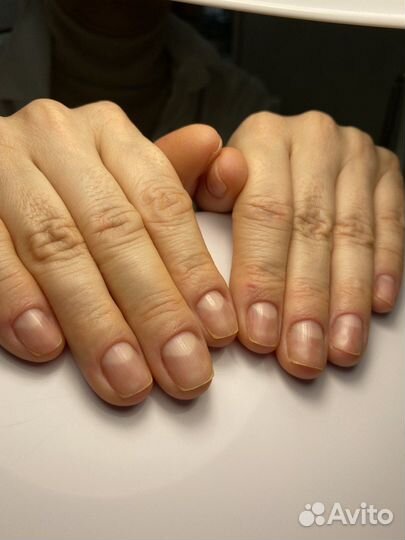 Аппаратный Педикюр, Маникюр. Коррекция ногтей