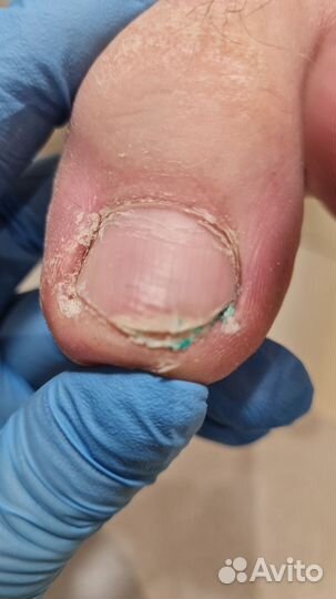 Мастер педикюра подолог