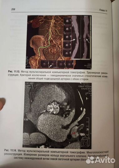 С. К. Терновой Томография сердца