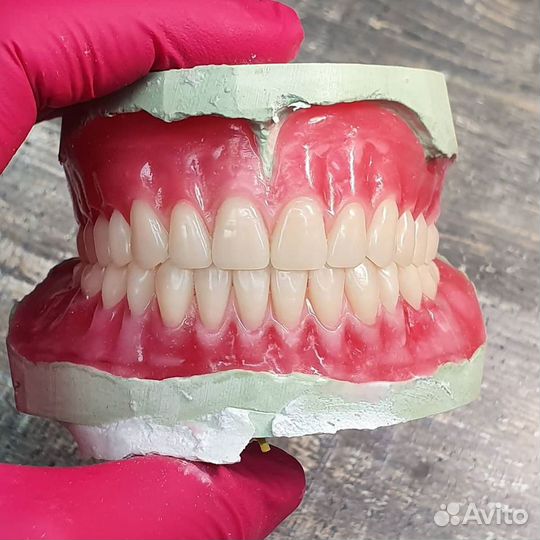 Изготовление зубных протезов с выездом на дом