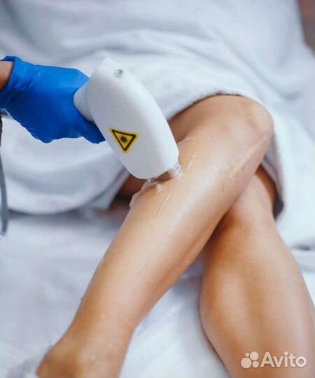 Бизнес лазерной эпиляции с клиентской базой