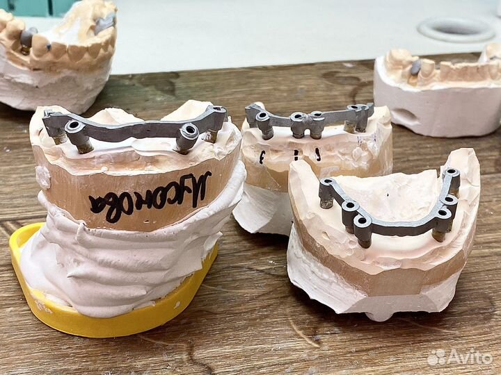 Зуботехническое литьё. Зубной техник литейщик