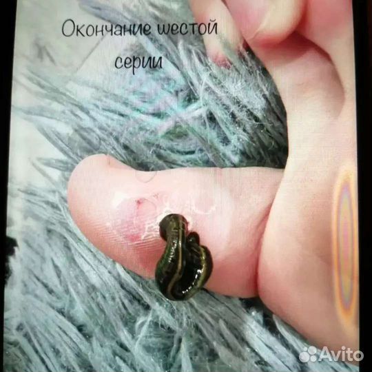Пиявки