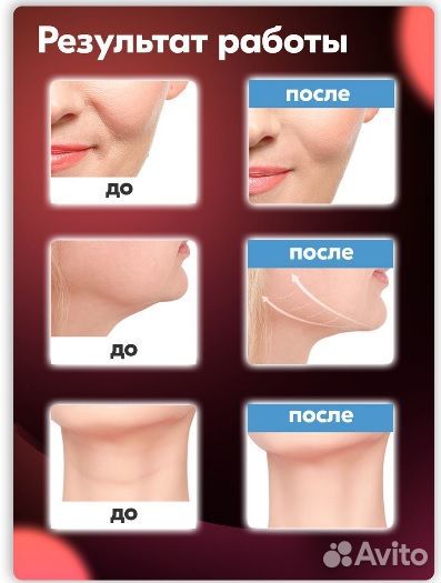 Вакуумный очиститель пор, аппарат для чистки лица