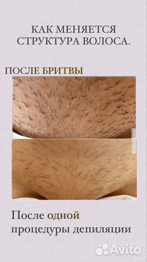Курсы обучение шугаринга