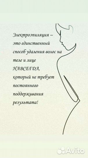 Электроэпиляция