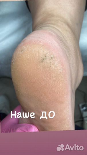 Маникюр/педикюр/наращивание ногтей
