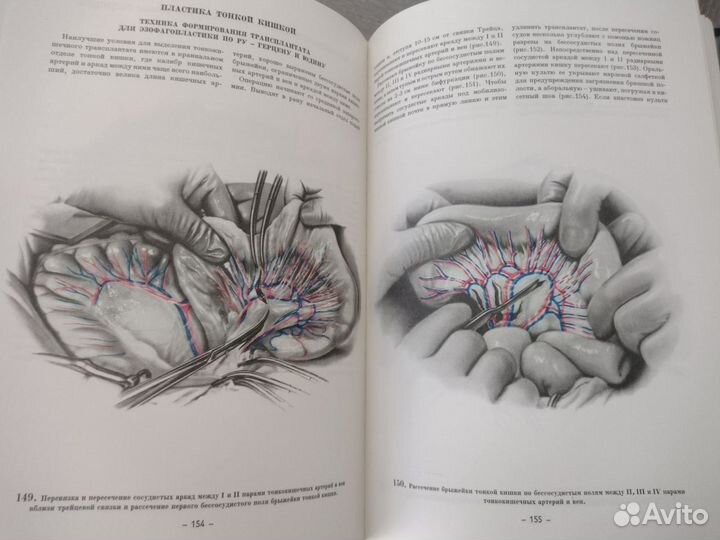 Книга по медицине атлас грудной хирургии 2 тома