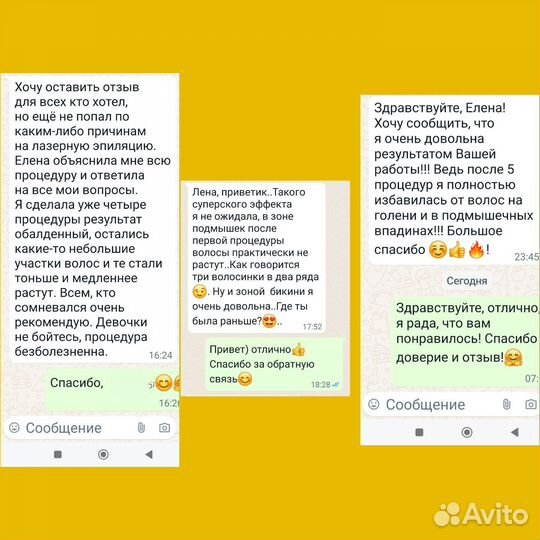 Лазерная эпиляция