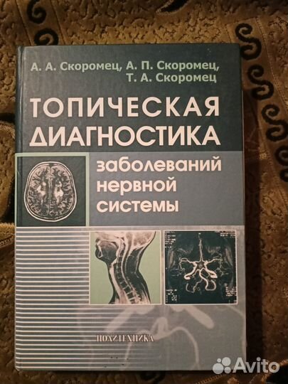 Топическая диагностика заболеваний нервной сист