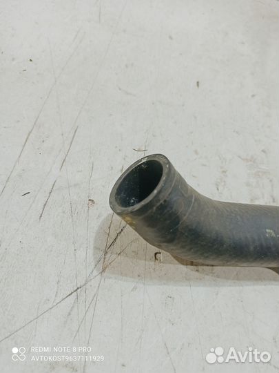 Патрубок радиатора верхний Hyundai-KIA