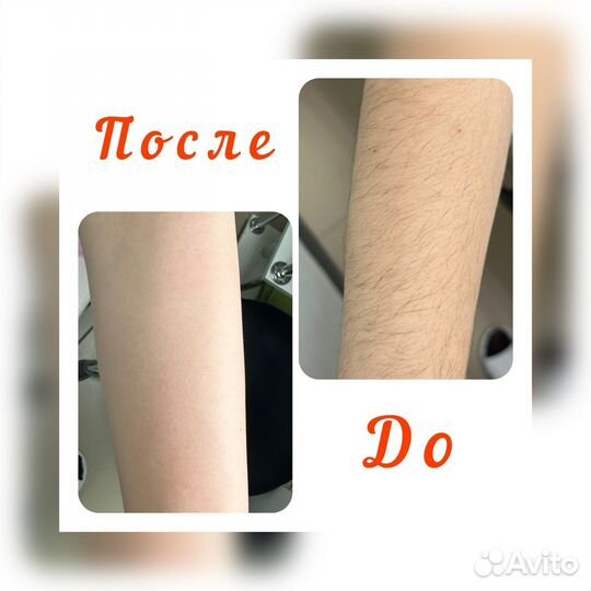 Шугаринг