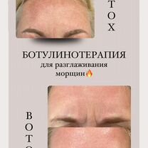 Косметолог, Ботокс, Био и Мезотерапия, Москва