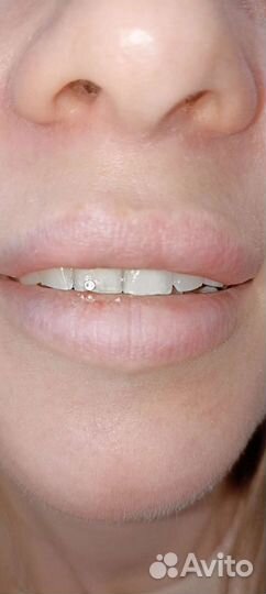 Скайсы, стразы на зубы