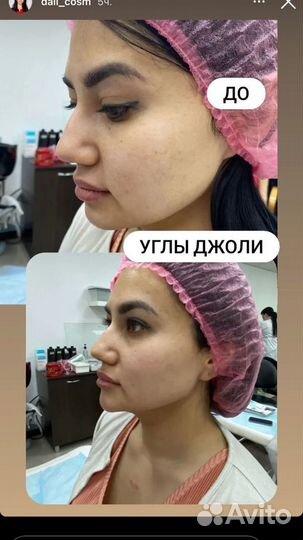 Услуги косметолога