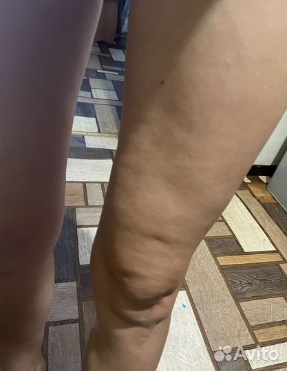 Массажист аппаратный