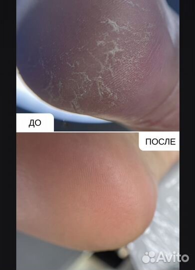 Педикюр,маникюр ЖК Чистое небо