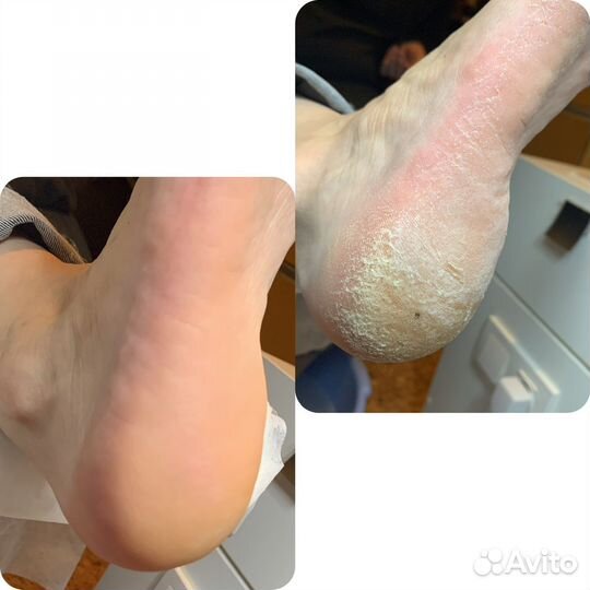 Подолог Мастер педикюра и маникюра