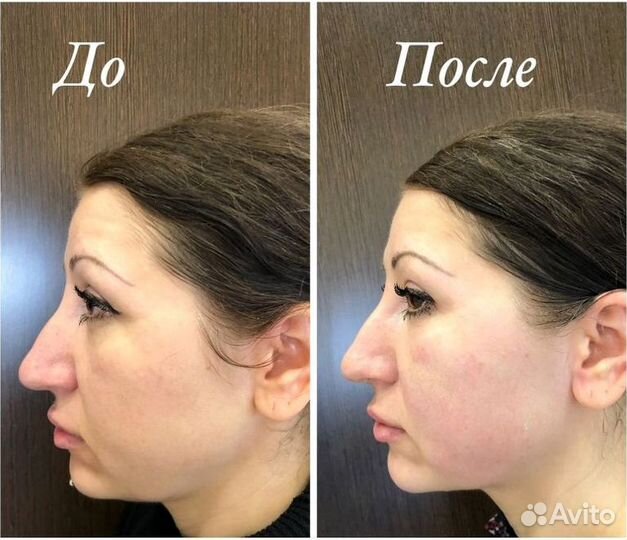 Модель на массаж антицеллюлитный
