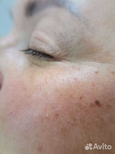 Уз чистка лица + маска